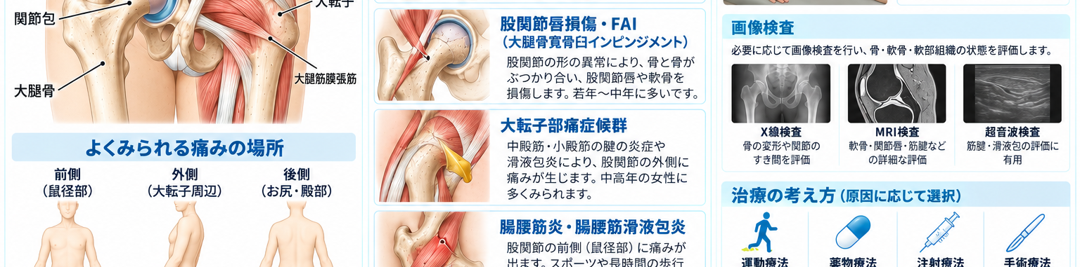 股関節痛の原因・評価・鑑別を示す医学イラスト