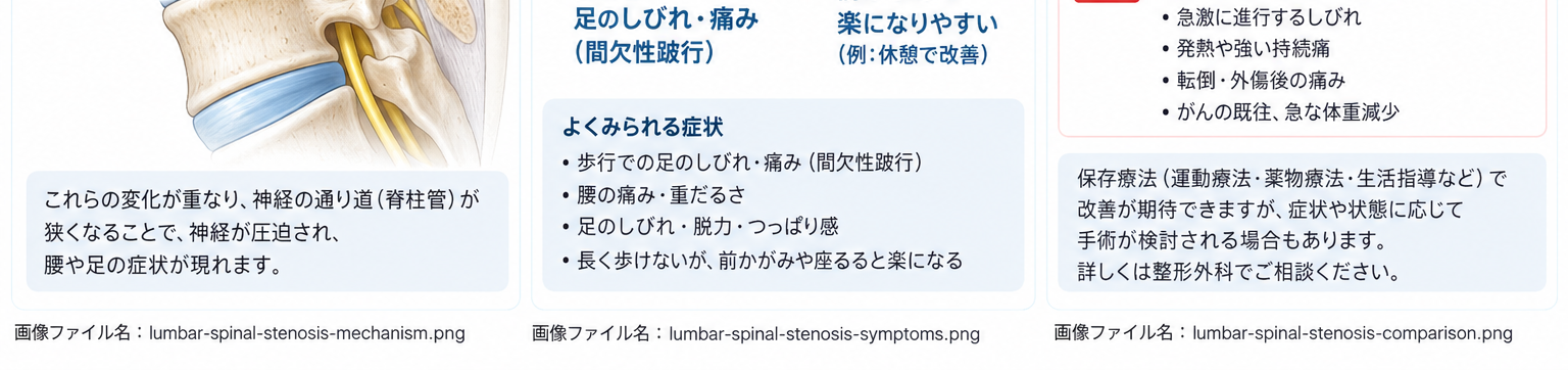 腰部脊柱管狭窄症の対処・治療・受診目安を示す医学イラスト