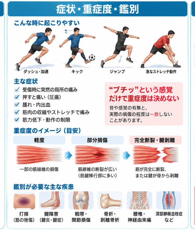肉離れの原因・評価・鑑別を示す医学イラスト