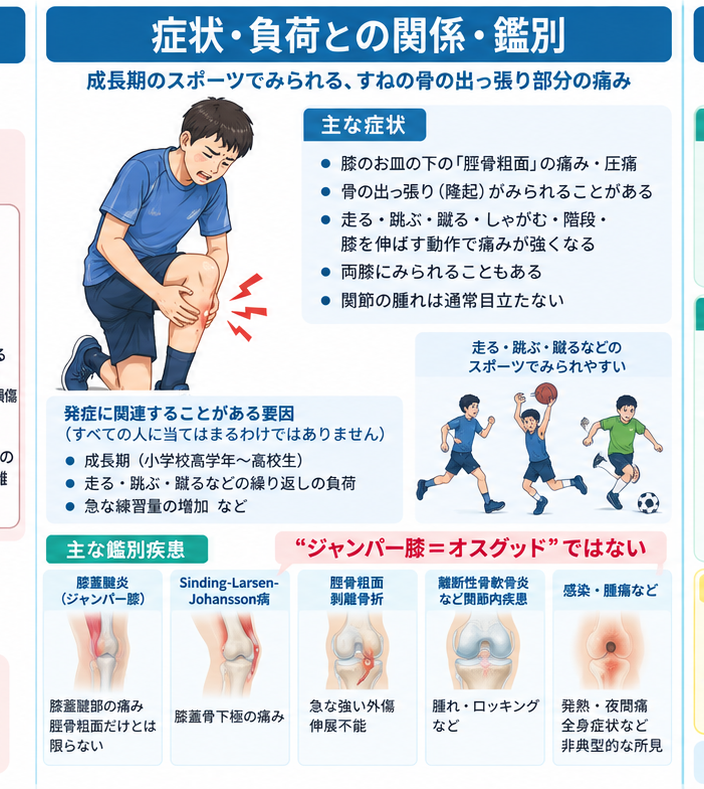 オスグッド病の原因・評価・鑑別を示す医学イラスト
