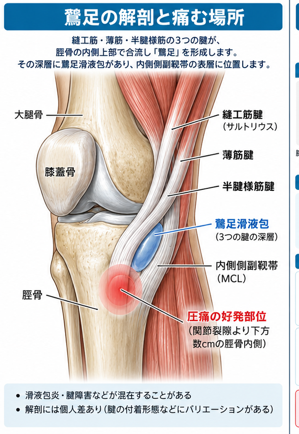 鵞足炎の症状・解剖・特徴を示す医学イラスト