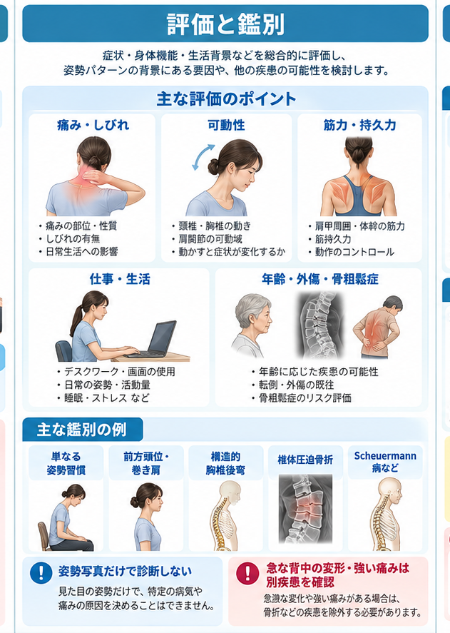 姿勢矯正の原因・評価・鑑別を示す医学イラスト