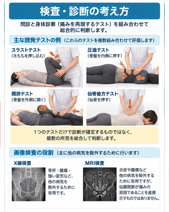 仙腸関節障害の原因・評価・鑑別を示す医学イラスト