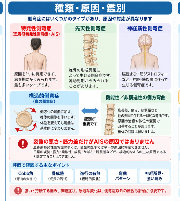 側弯症の原因・評価・鑑別を示す医学イラスト