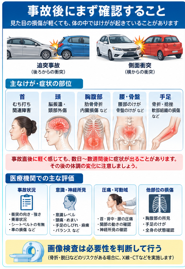 交通事故治療の症状・解剖・特徴を示す医学イラスト