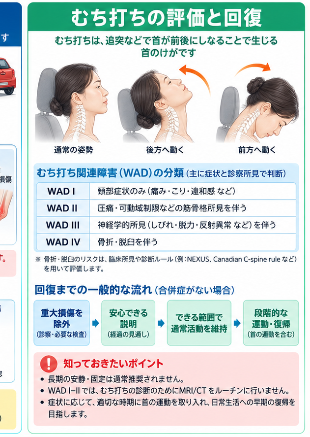 交通事故治療の原因・評価・鑑別を示す医学イラスト